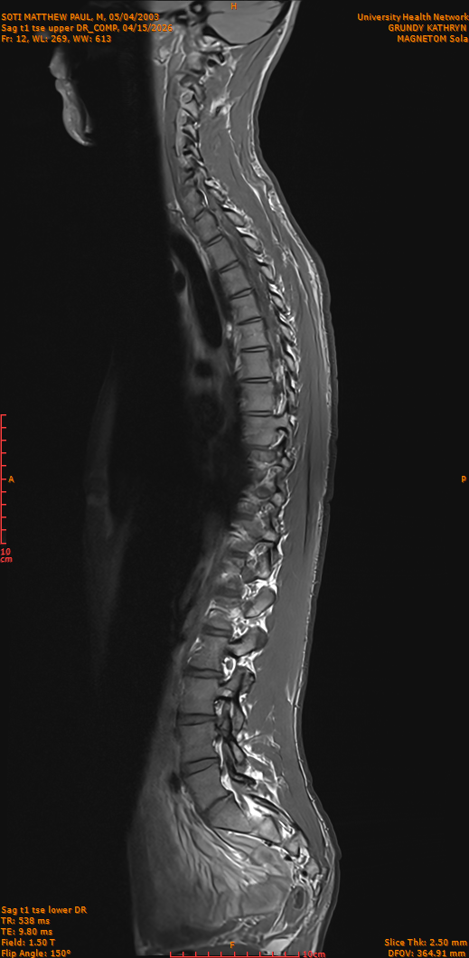 2026-04-15/Entire Spine/Sag t1 tse upper DR_COMP/0013-IM262.png