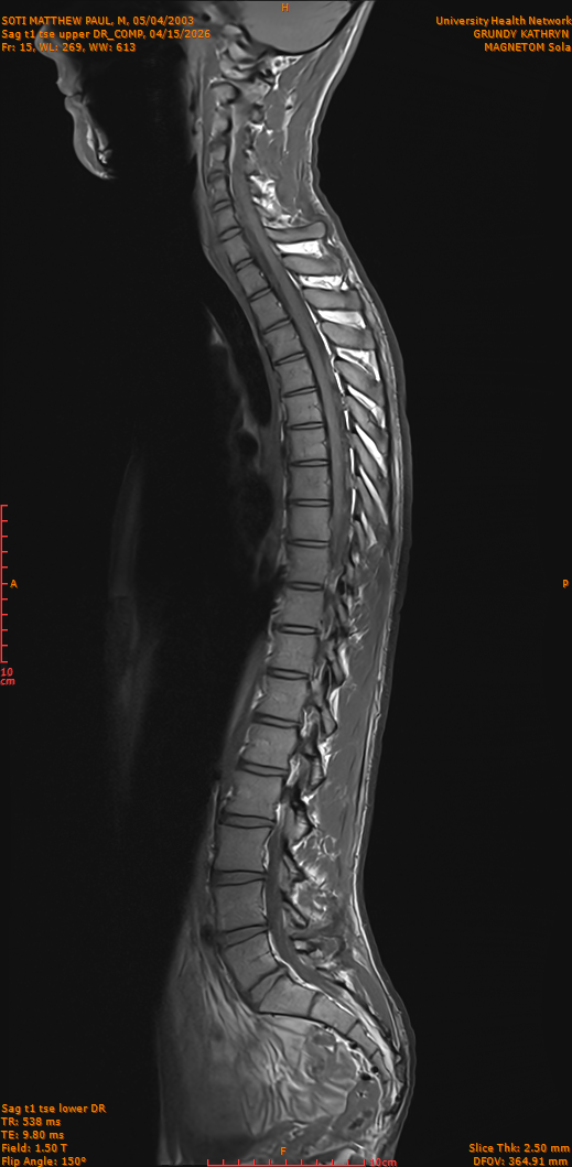 2026-04-15/Entire Spine/Sag t1 tse upper DR_COMP/0016-IM265.png