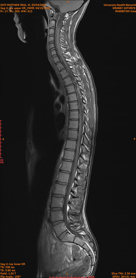 2026-04-15/Entire Spine/Sag t1 tse upper DR_COMP/0018-IM267.png