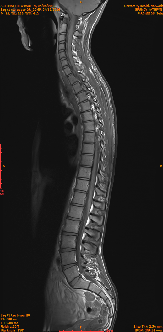 2026-04-15/Entire Spine/Sag t1 tse upper DR_COMP/0019-IM268.png