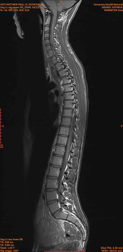 2026-04-15/Entire Spine/Sag t1 tse upper DR_COMP/0020-IM269.png