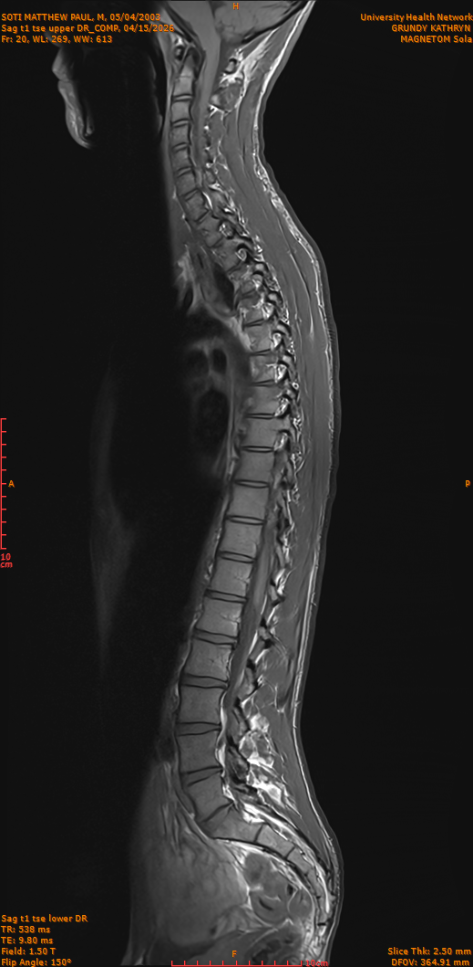 2026-04-15/Entire Spine/Sag t1 tse upper DR_COMP/0021-IM270.png