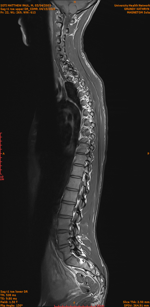 2026-04-15/Entire Spine/Sag t1 tse upper DR_COMP/0023-IM272.png