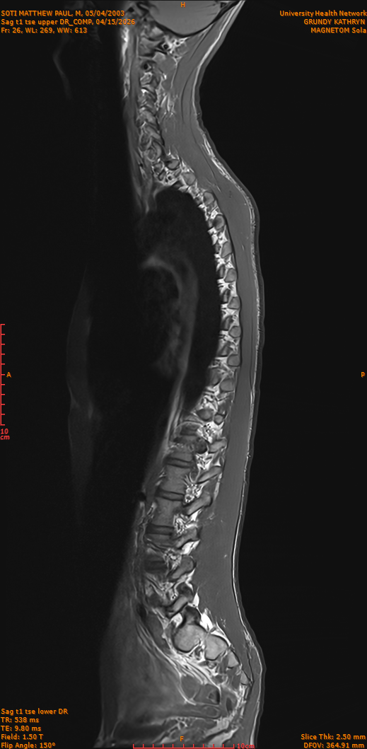 2026-04-15/Entire Spine/Sag t1 tse upper DR_COMP/0027-IM276.png
