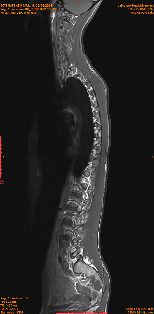 2026-04-15/Entire Spine/Sag t1 tse upper DR_COMP/0028-IM277.png