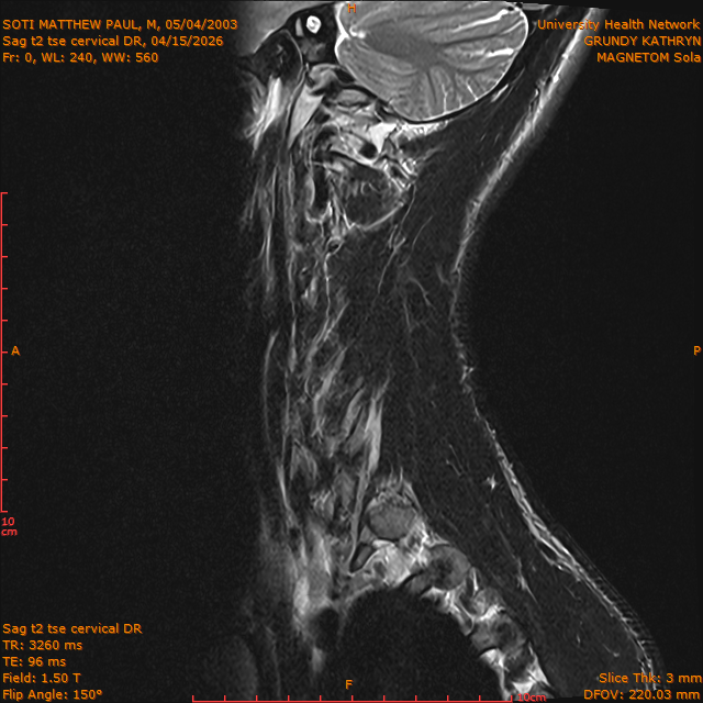 2026-04-15/Entire Spine/Sag t2 tse Cervical DR/0001-IM287.png