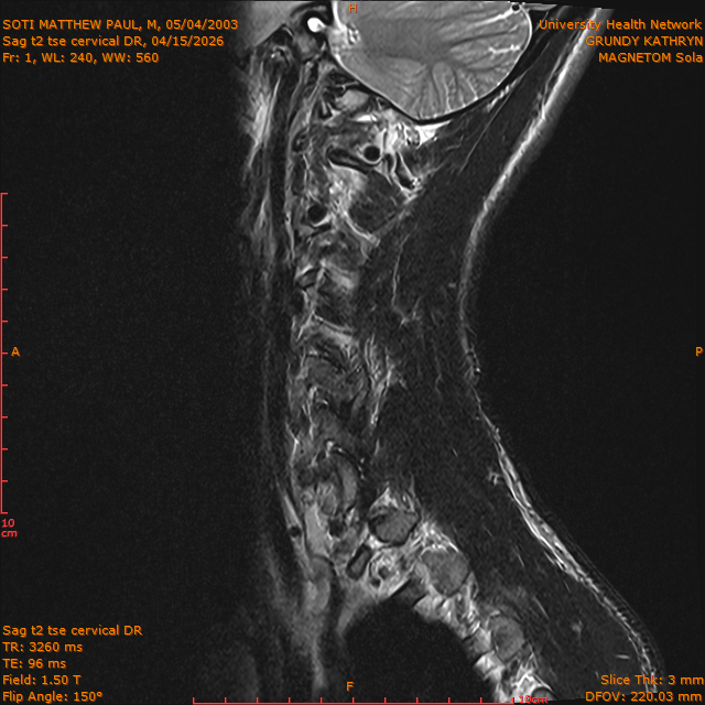 2026-04-15/Entire Spine/Sag t2 tse Cervical DR/0002-IM288.png