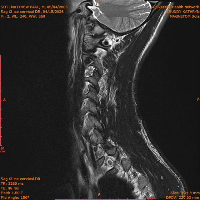 2026-04-15/Entire Spine/Sag t2 tse Cervical DR/0003-IM289.png