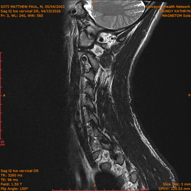 2026-04-15/Entire Spine/Sag t2 tse Cervical DR/0004-IM290.png