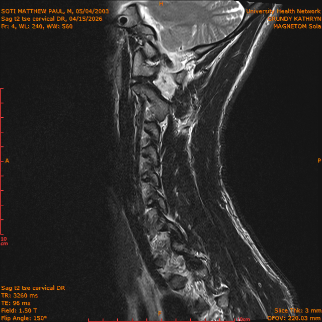 2026-04-15/Entire Spine/Sag t2 tse Cervical DR/0005-IM291.png