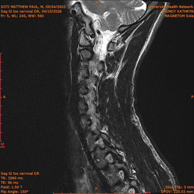 2026-04-15/Entire Spine/Sag t2 tse Cervical DR/0006-IM292.png