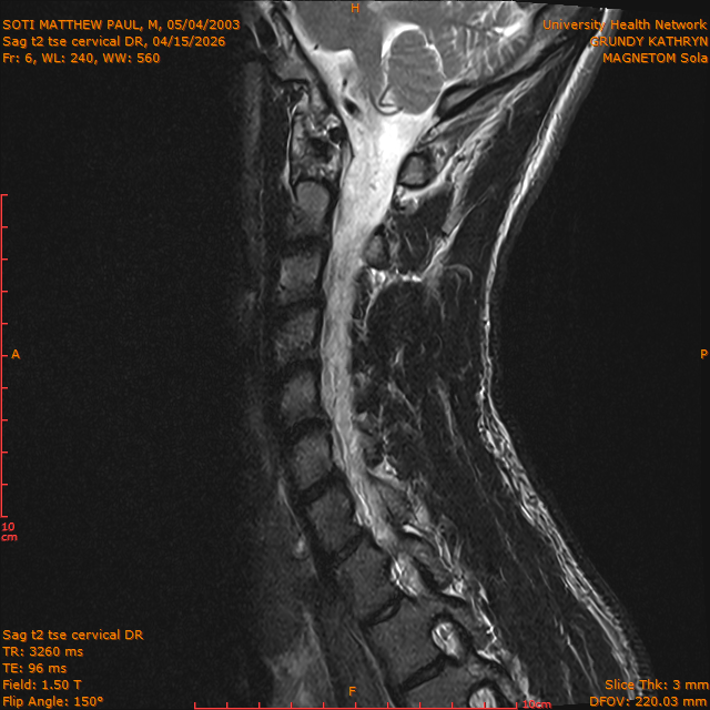 2026-04-15/Entire Spine/Sag t2 tse Cervical DR/0007-IM293.png