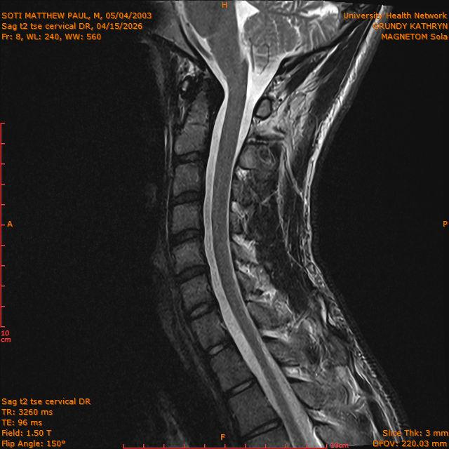 2026-04-15/Entire Spine/Sag t2 tse Cervical DR/0009-IM295.png