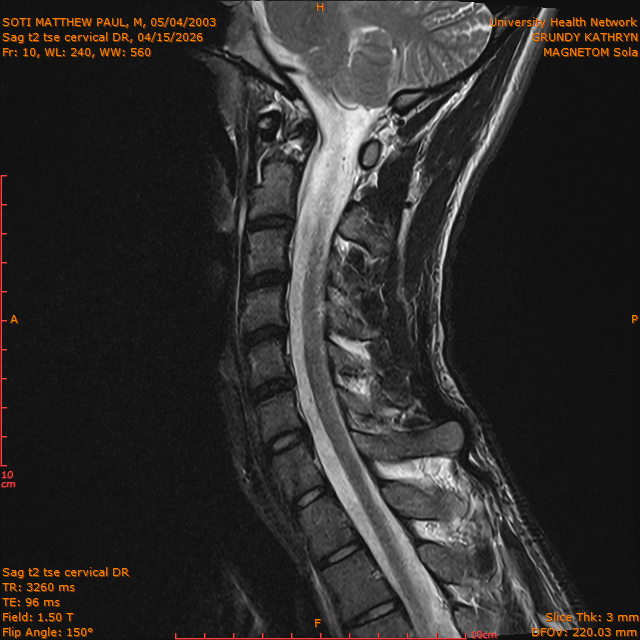 2026-04-15/Entire Spine/Sag t2 tse Cervical DR/0011-IM297.png