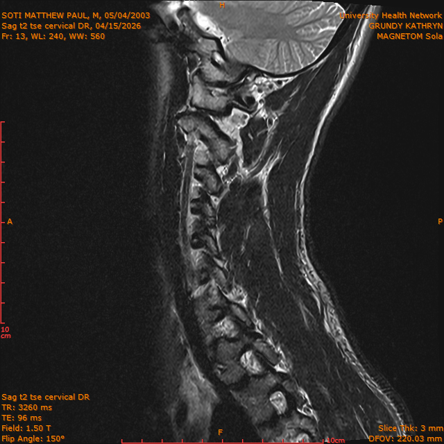 2026-04-15/Entire Spine/Sag t2 tse Cervical DR/0014-IM300.png