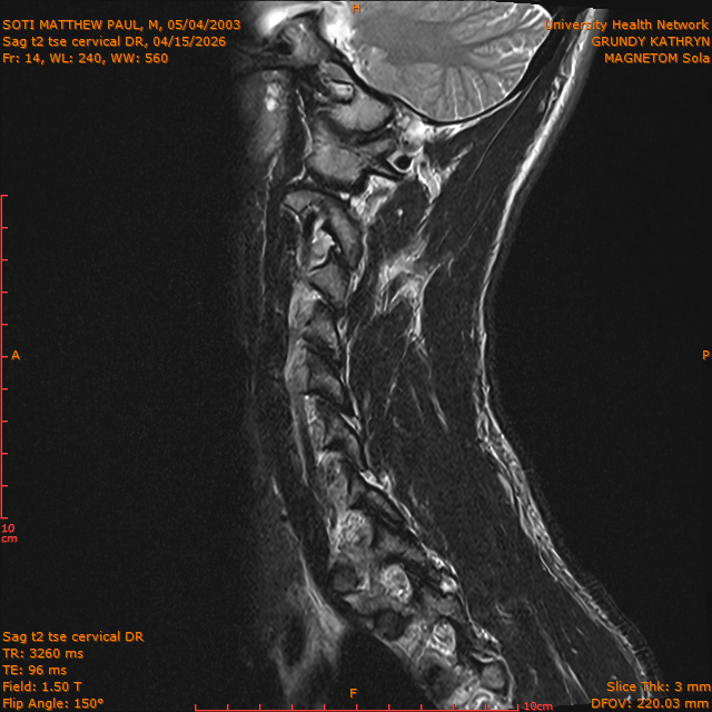 2026-04-15/Entire Spine/Sag t2 tse Cervical DR/0015-IM301.png