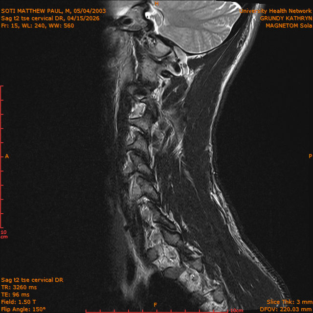 2026-04-15/Entire Spine/Sag t2 tse Cervical DR/0016-IM302.png