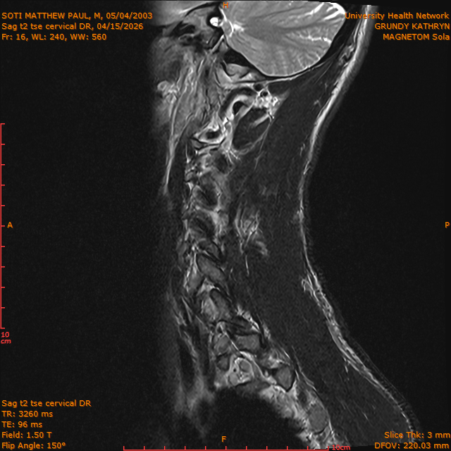 2026-04-15/Entire Spine/Sag t2 tse Cervical DR/0017-IM303.png