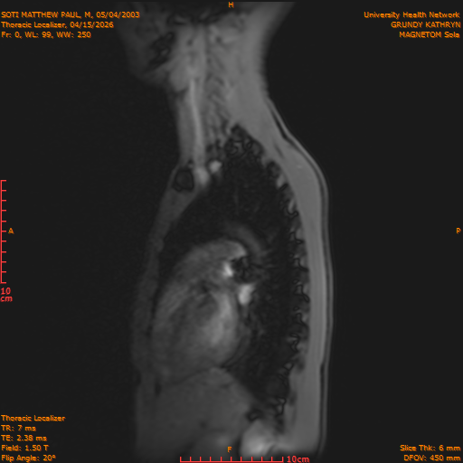 2026-04-15/Entire Spine/Thoracic Localizer/0001-IM148.png