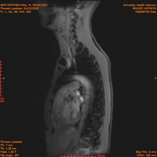 2026-04-15/Entire Spine/Thoracic Localizer/0002-IM149.png