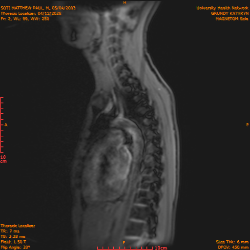 2026-04-15/Entire Spine/Thoracic Localizer/0003-IM150.png