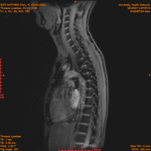 2026-04-15/Entire Spine/Thoracic Localizer/0004-IM151.png