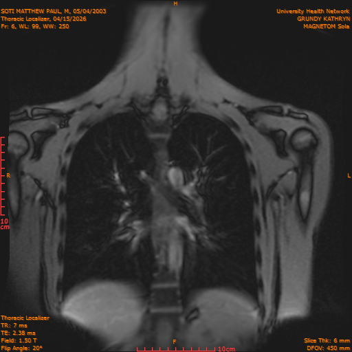 2026-04-15/Entire Spine/Thoracic Localizer/0007-IM154.png