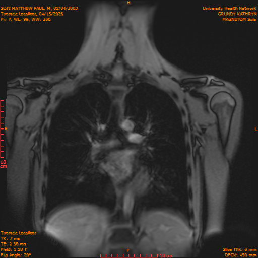 2026-04-15/Entire Spine/Thoracic Localizer/0008-IM155.png