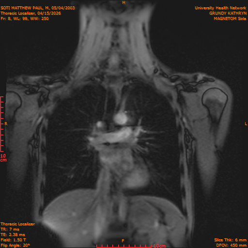 2026-04-15/Entire Spine/Thoracic Localizer/0009-IM156.png