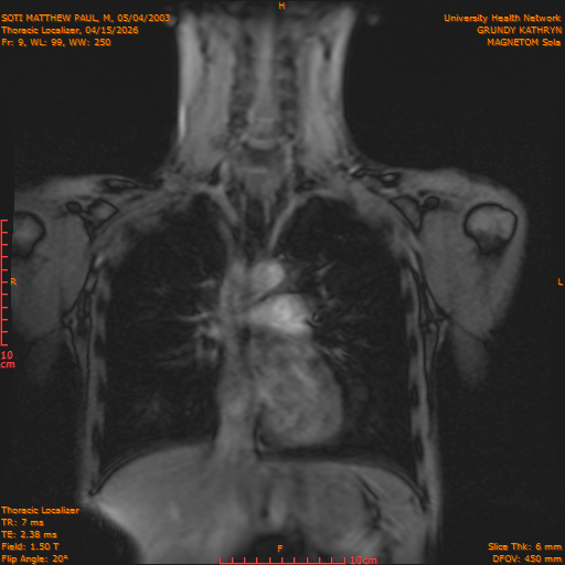 2026-04-15/Entire Spine/Thoracic Localizer/0010-IM157.png