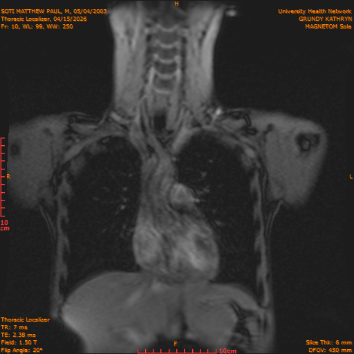 2026-04-15/Entire Spine/Thoracic Localizer/0011-IM158.png