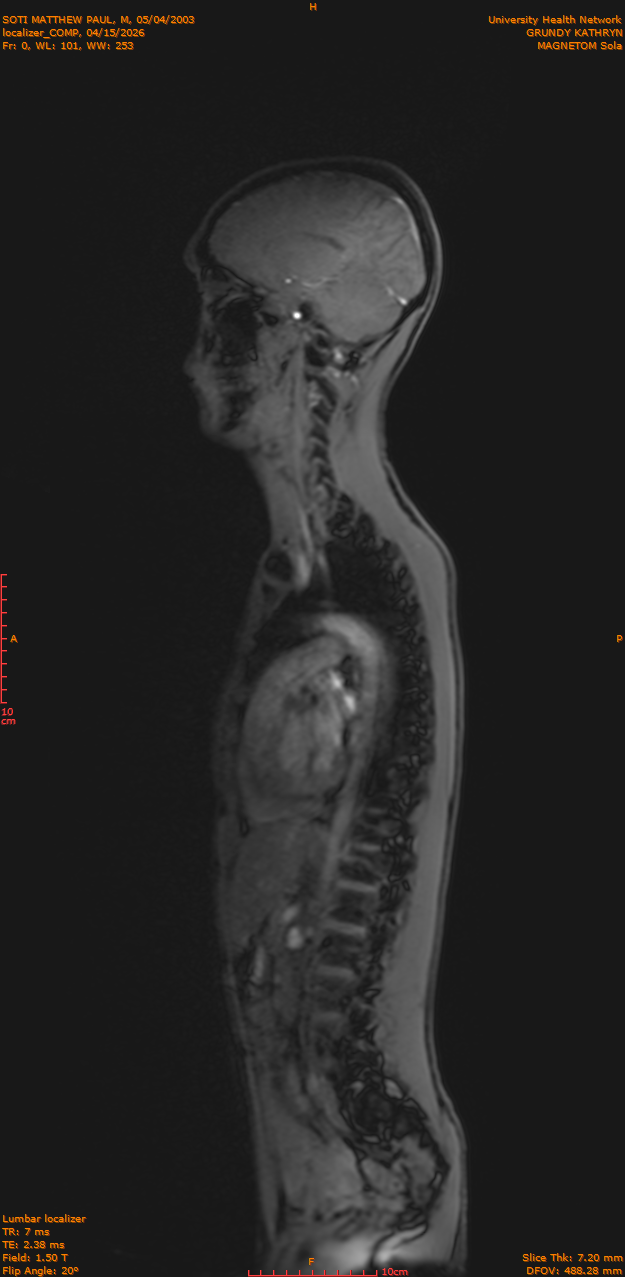 2026-04-15/Entire Spine/localizer_COMP/0001-IM170.png
