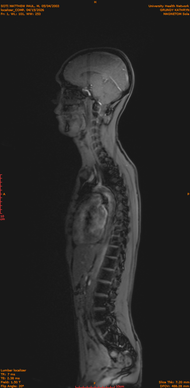 2026-04-15/Entire Spine/localizer_COMP/0002-IM171.png