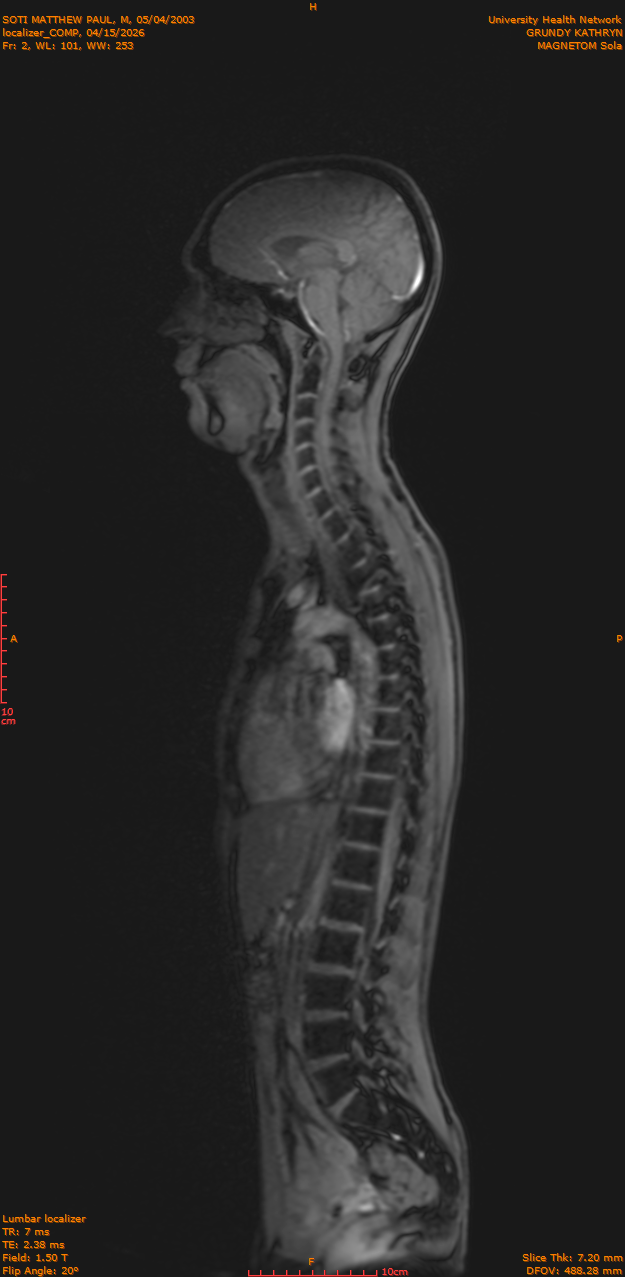 2026-04-15/Entire Spine/localizer_COMP/0003-IM172.png