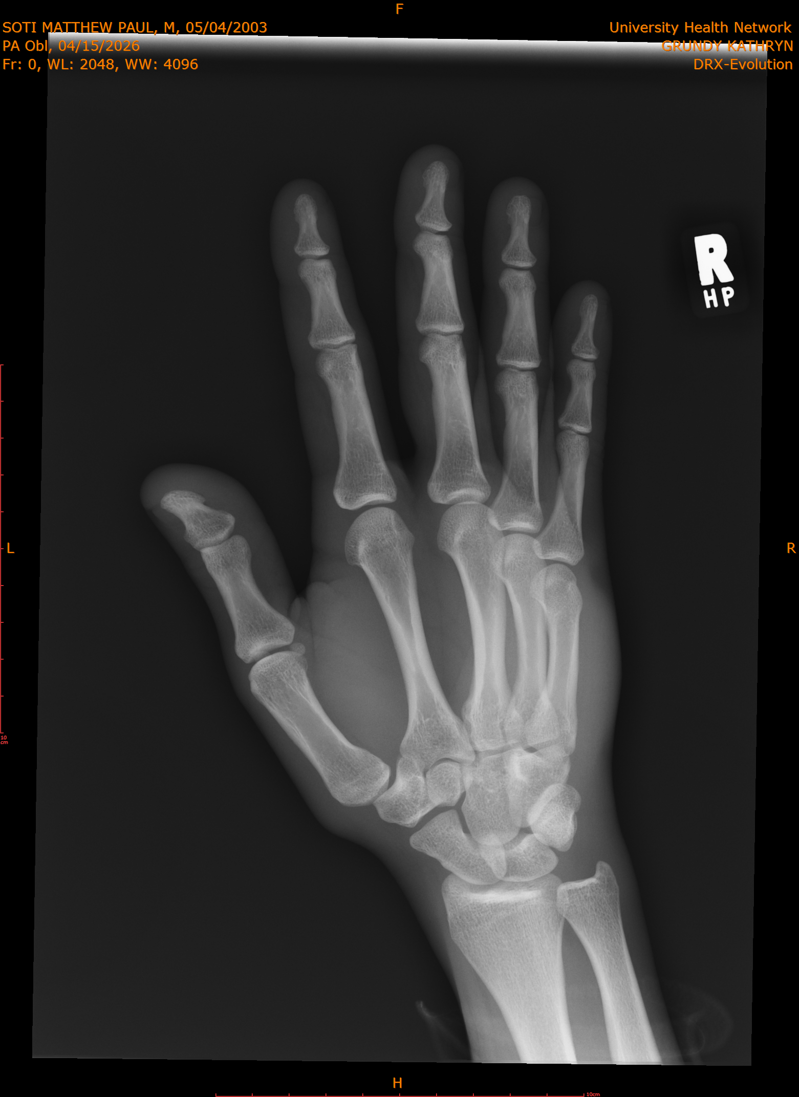 2026-04-15/Right Hand/PA Obl/0001-.png